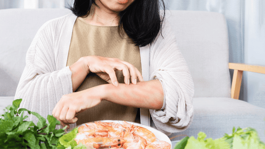 Nurturing Your Skin: A Nutritional Compass for Eczema Management